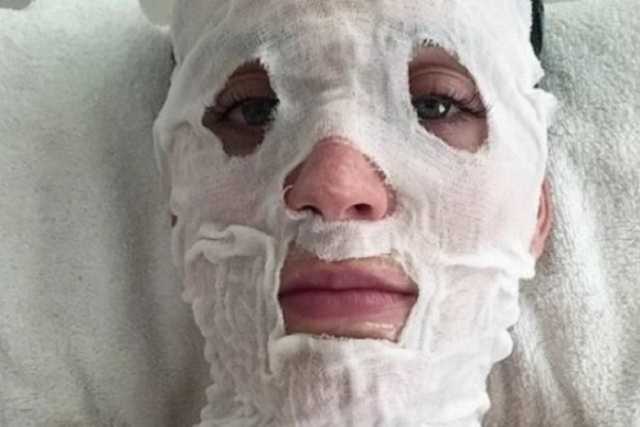 На Буковине неадекватный депутат облил кислотой бывшую супругу