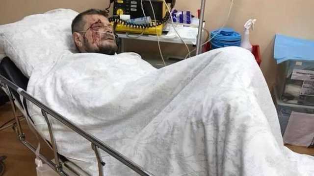 "Взорвали припаркованную машину": Подробности покушения на Мосийчука