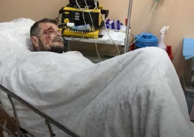 Покушение на Мосийчука: появились фото вытащенных во время операции осколков