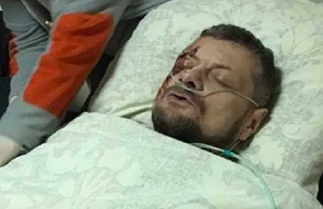 МВД назвало основную версию покушения на Мосийчука