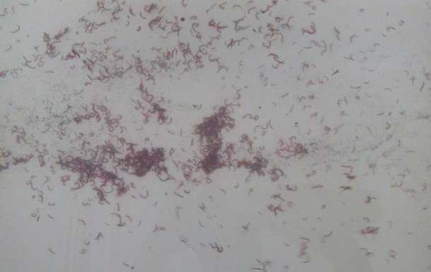 В Одесской области из кранов течет вода с червями