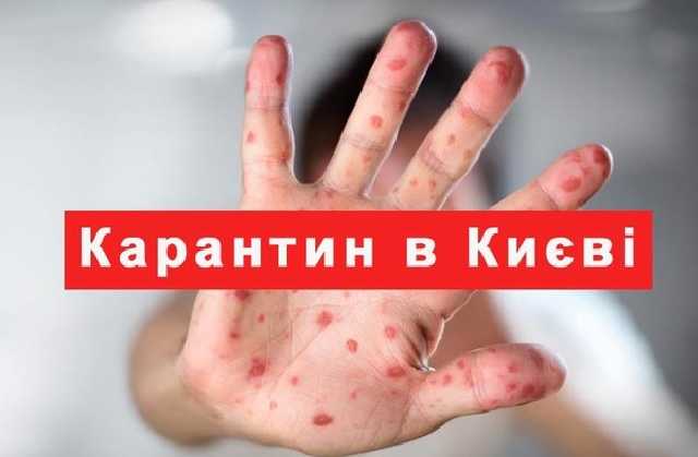 Киевская школа объявила карантин из-за распространения кори