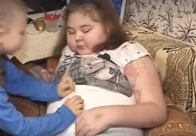 Набрала 20 кг и почти не может ходить: 14-летнюю украинку сразила редчайшая болезнь