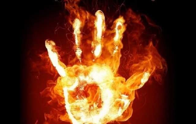 У Житомирській області на пожежі у приватній оселі постраждало двоє малолітніх дітей