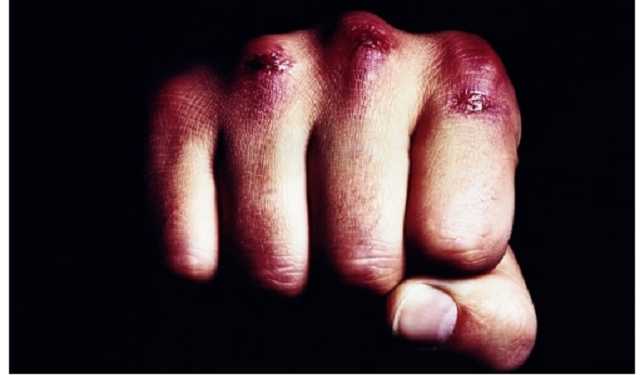 За попытку кражи элитного авто насмерть забили мужчину