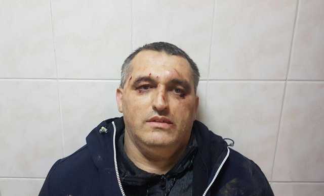 В Черновцах неизвестные жестоко избили представителя организации "Стоп коррупции"