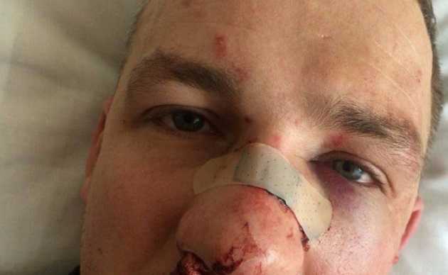 Избиение нардепа Левченко: прокуратура Киева расследует насилие в отношении государственного деятеля