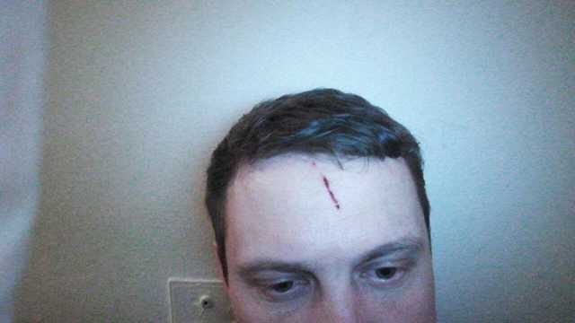 На Киевщине в Украинке совершено нападение на депутата от Укропа Максима Винника