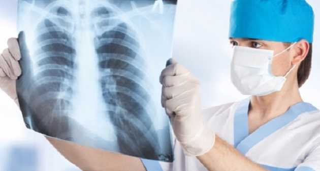 Минздрав отменил флюорографию: чем заменят