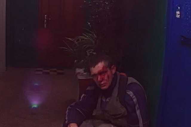 В Одессе избили живодера, который убивал животных при ребенке