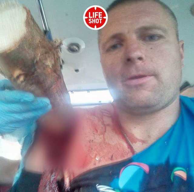 "Как на кол посадили": экстремала из Беларуси насквозь пробило сосной