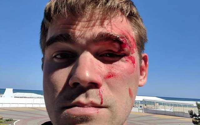 "Будеш меня учить": в Киеве владелец магазина жестко избил покупателя