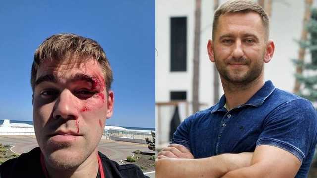 Кровавый оффлайн. За что CEO интернет-магазина Stylus избил своего клиента