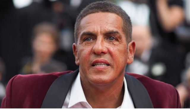 Глаз не видно: появилось первое фото избитой в России звезды "Такси"