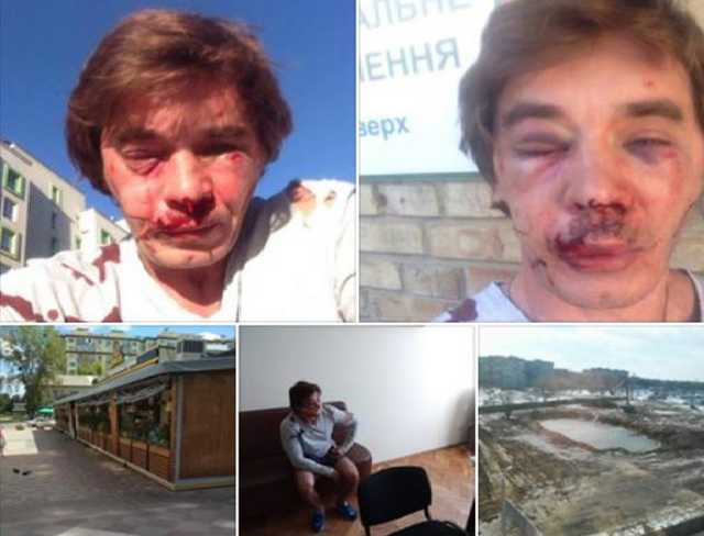 У Вишневому побили активіста, який боровся з забудовниками зеленої зони