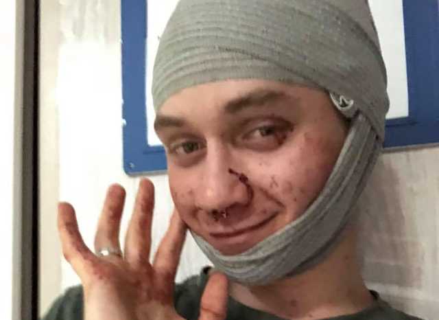 На Андреевском спуске избили двух человек из-за подозрения в гомосексуализме