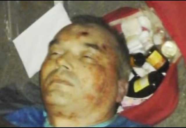 Стрельба в Харькове: появилось посмертное фото убийцы полицейского