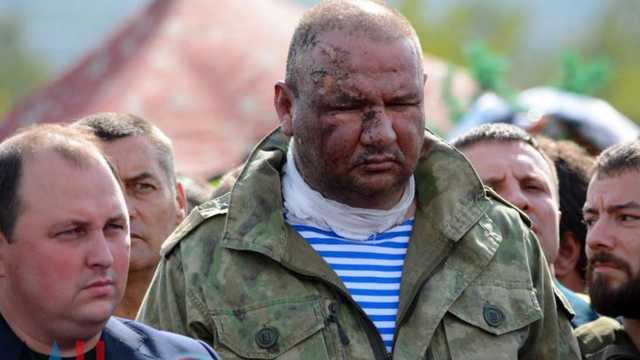 «Отделался легким испугом». Раненый «Ташкент» дал первое интервью о случившемся