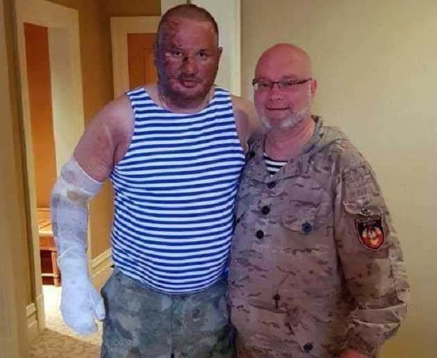 Обгоревший и в бинтах: появилось новое фото "воскресшего" Ташкента