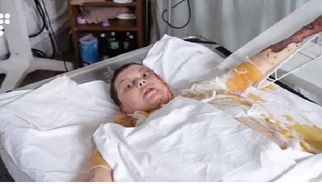 Как выглядит Екатерина Гандзюк, которую облили кислотой: активистка записала видеообращение