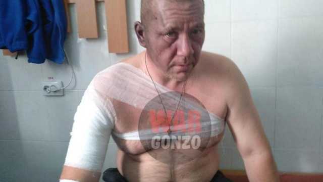 «Правоохранители ДНР» назвали инсценировкой «покушение» на Хакимзянова