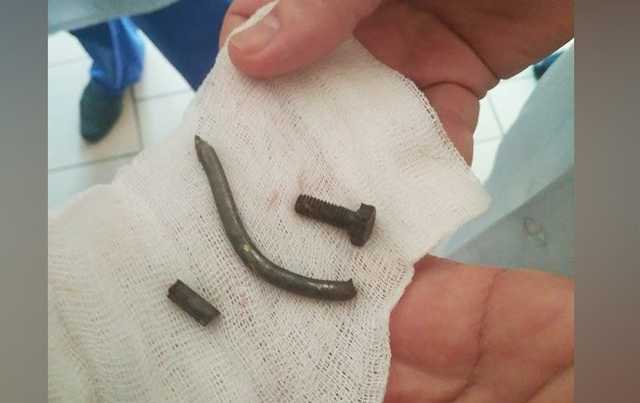 Доставали болты и гвозди: появились жуткие подробности о раненых после бойни в Керчи