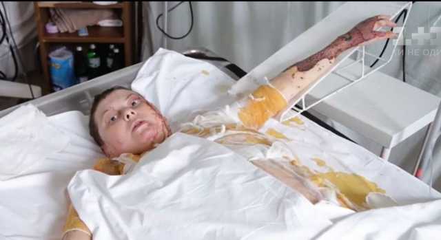 ’’Виновные будут найдены и наказаны!’’ В сети напомнили последнее обращение Гандзюк к украинцам