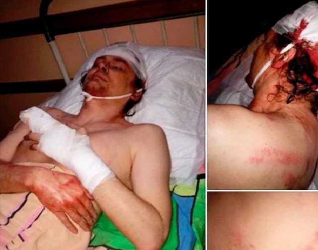 Самые громкие нападения на общественных активистов, произошедшие в Украине в 2018-м