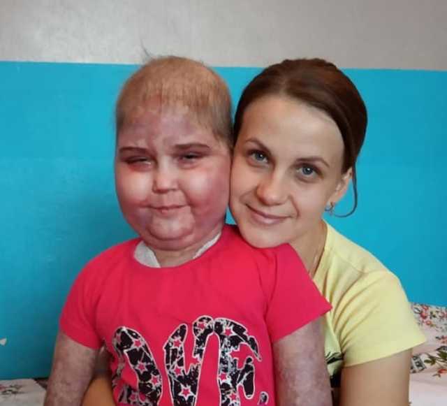 ’’Выписали в кровавых бинтах’’: в ’’Охматдете’’ ребенка с раком выставили на улицу