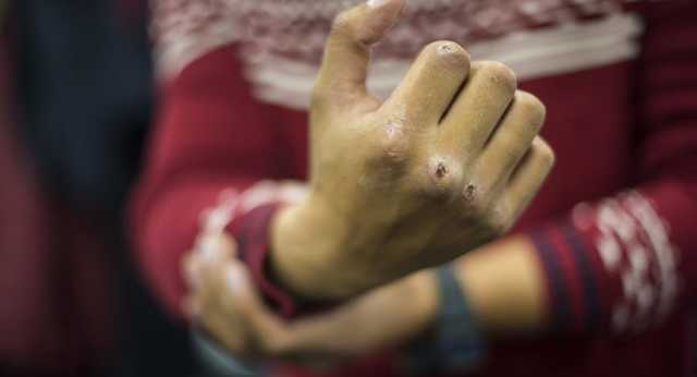 На Херсонщине произошла драка к поножовщиной между военнослужащими ВСУ и жителями села