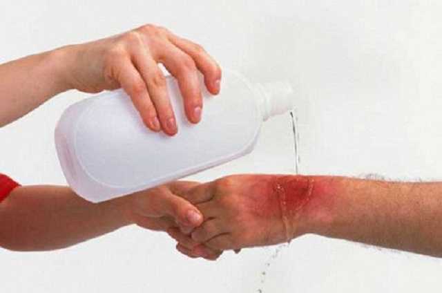 Наказание кислотой: как в Украине мстят за «измену»