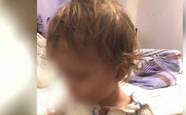 “Рот в крови, все в гематомах”: в Одессе няню обвинили в избиении малыша