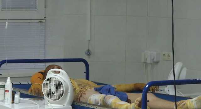 На Луганщине подросток спас дедушку из пожара, но сам попал в реанимацию