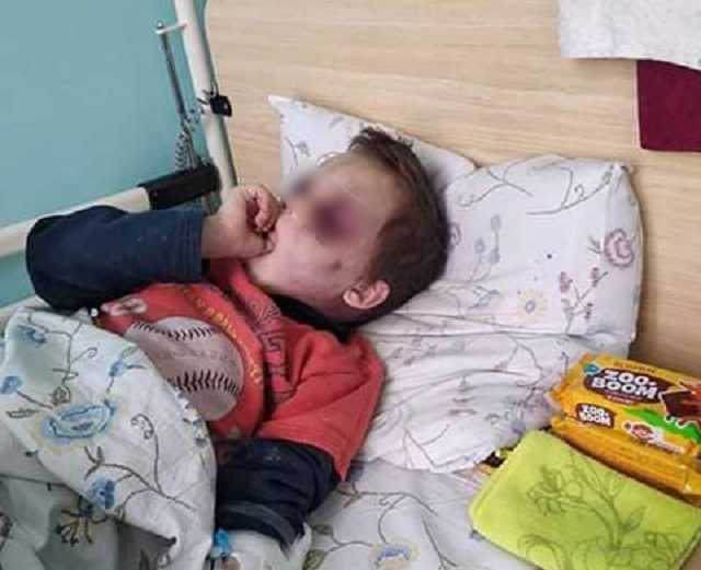 Под Винницей зверски избили 6-летнего ребенка: новые подробности и жуткие фото