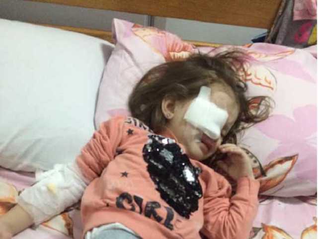 Во время драки в детсаду в Днепре девочке проткнули глаз карандашом