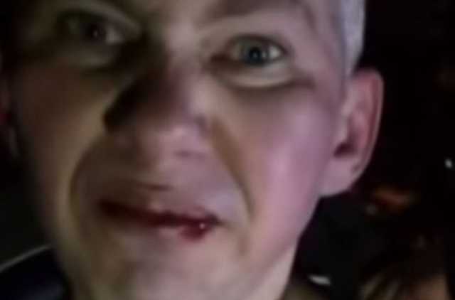 В Запорожье педофилу пришлось жевать презервативы