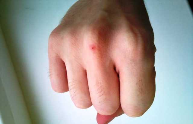 В Одессе водитель троллейбуса избил пьяного пассажира