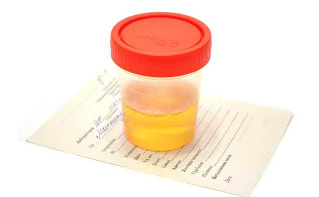 У Чернівцях нетверезий водій возив із собою сечу для підміни аналізу на сп’яніння