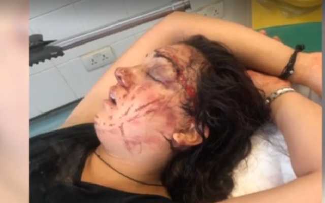 С пробитой головой: в Камбодже с украинкой случилось загадочное ЧП