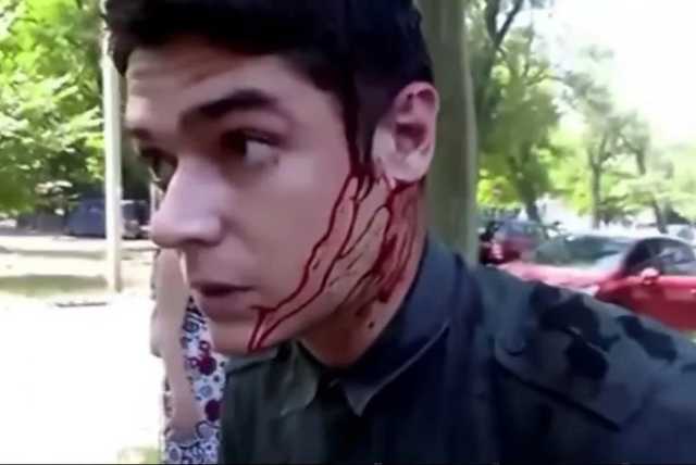 Один из организаторов нападения на одесского активиста Устименко вышел на свободу