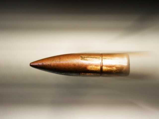 В Тернополе у женщины обнаружили пулю в голове