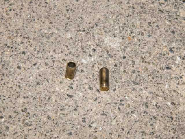 Получил две пули в живот за анекдот: в Киеве ночью стреляли