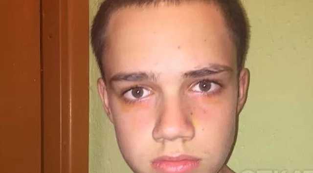 В Одессе охранник торгового центра забрызгал лицо подростку токсичным веществом