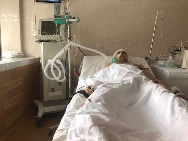 На Донбассе тяжело ранен доброволец-парамедик с позывным “Смурфик”