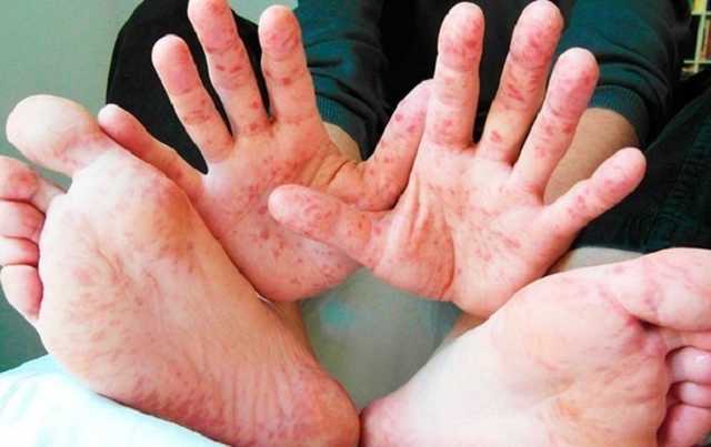 Израиль внес Украину в перечень опасных стран