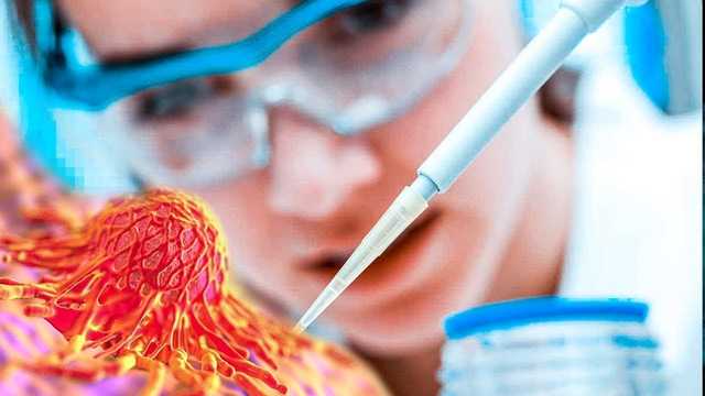 Рак косит украинцев: какие изменения готовят