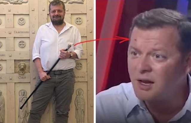 Мосийчук жестоко избил Ляшко тростью: журналисты узнали резонансные детали