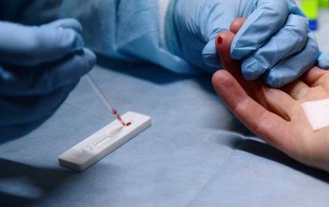 Украина переходит на новые стандарты лечения ВИЧ