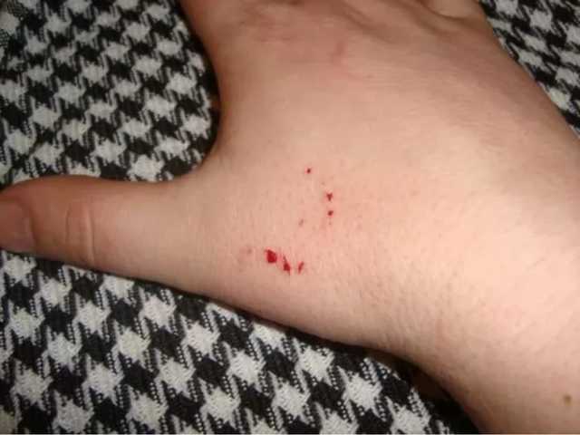 Запорожскую область атакуют змеи: двоих людей госпитализировали с укусами