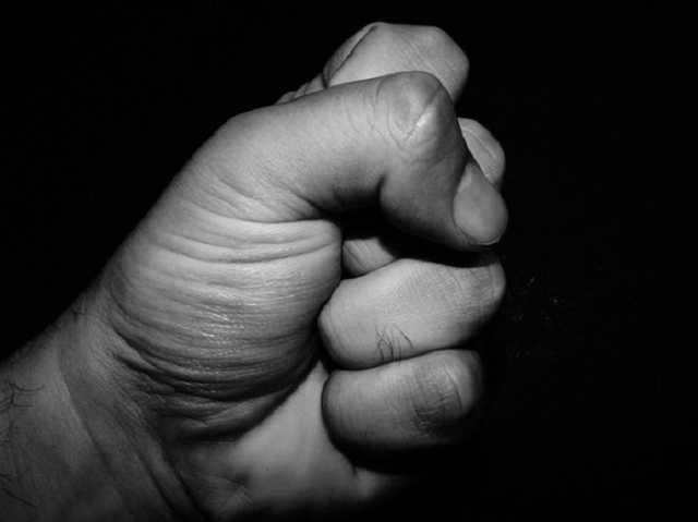 В Минске жестоко избили музыканта группы «Ляпис Трубецкой»